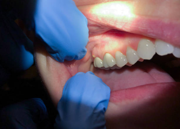 Best Orthodontic Emergency Dentist in Nes, IL